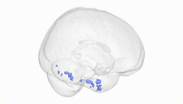 Full Brain White