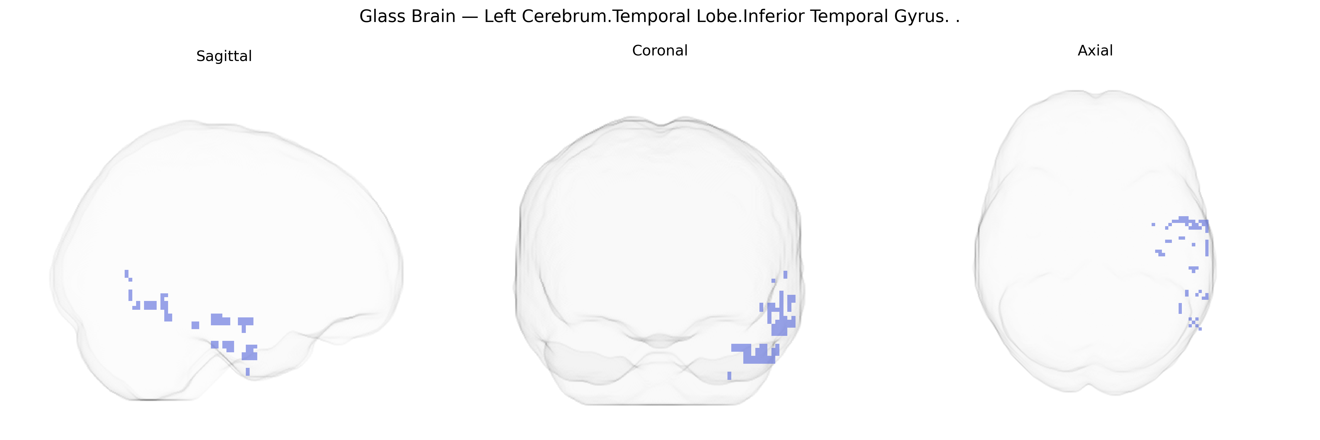 Triplanar Ghost Brain