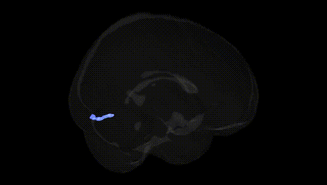 Full Brain Black