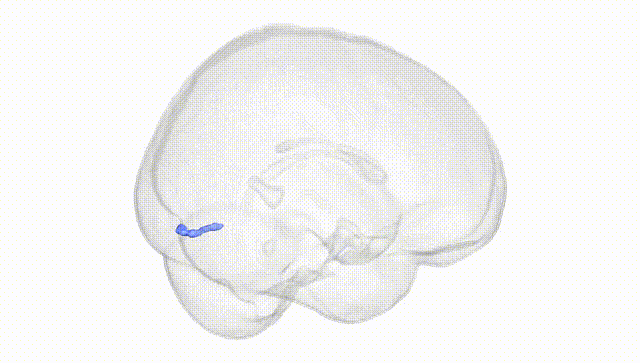 Full Brain White