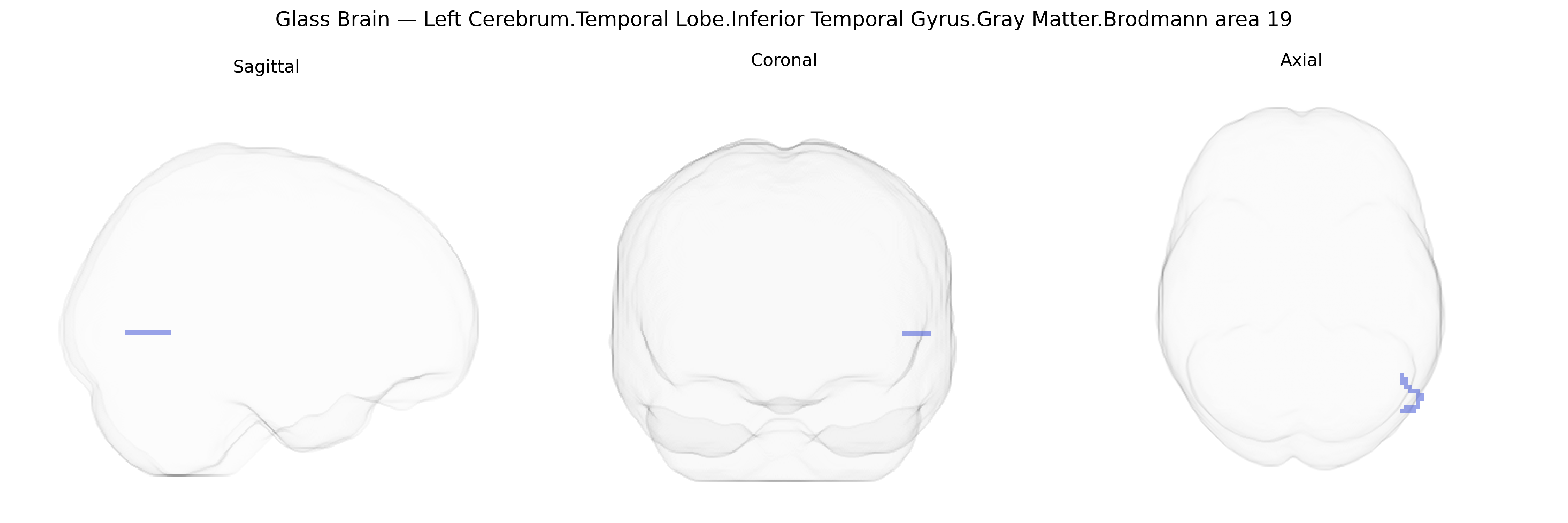 Triplanar Ghost Brain