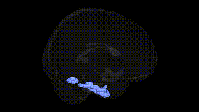 Full Brain Black