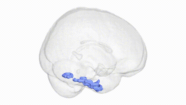 Full Brain White