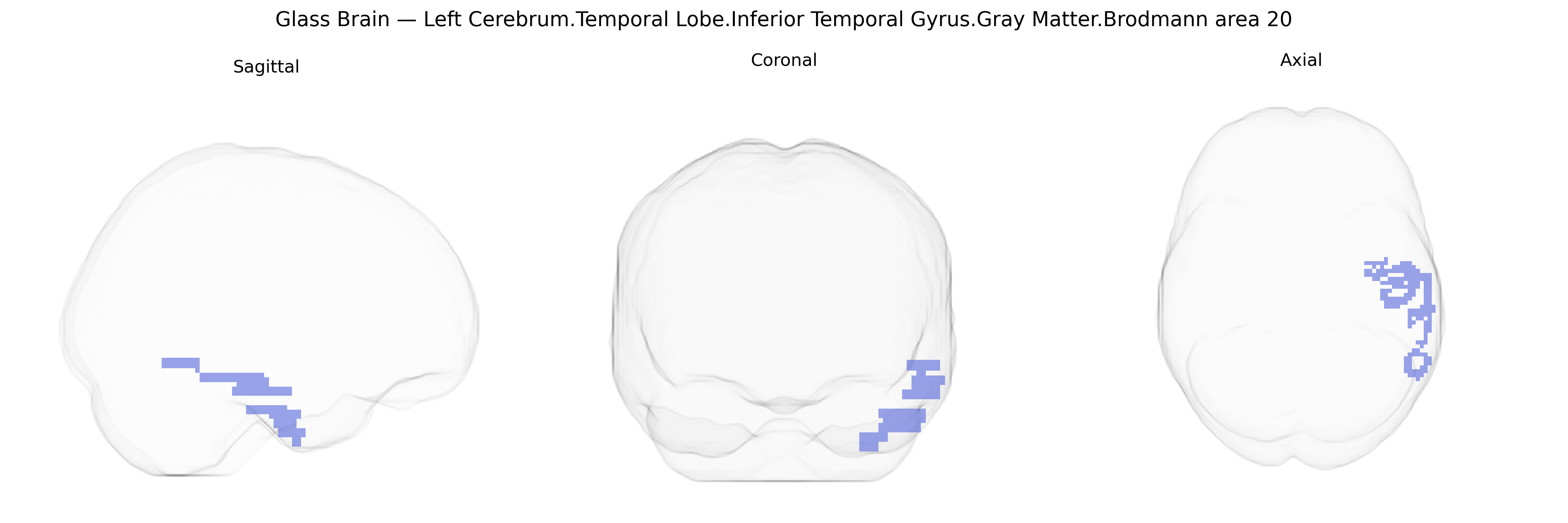 Triplanar Ghost Brain
