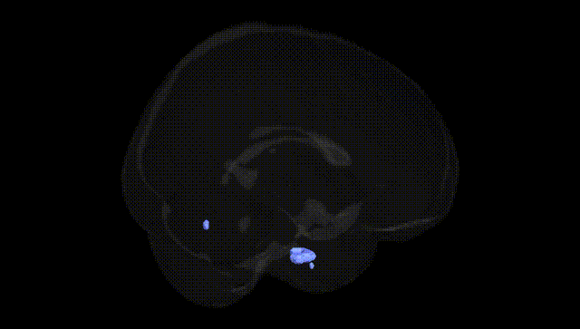 Full Brain Black