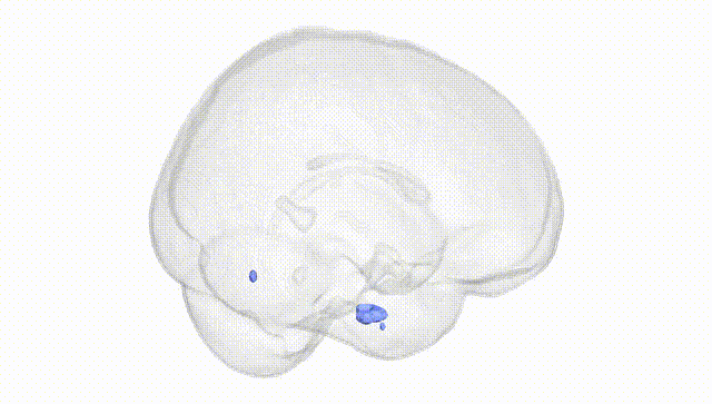 Full Brain White