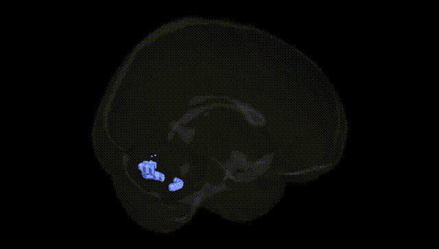 Full Brain Black