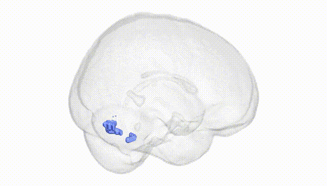 Full Brain White