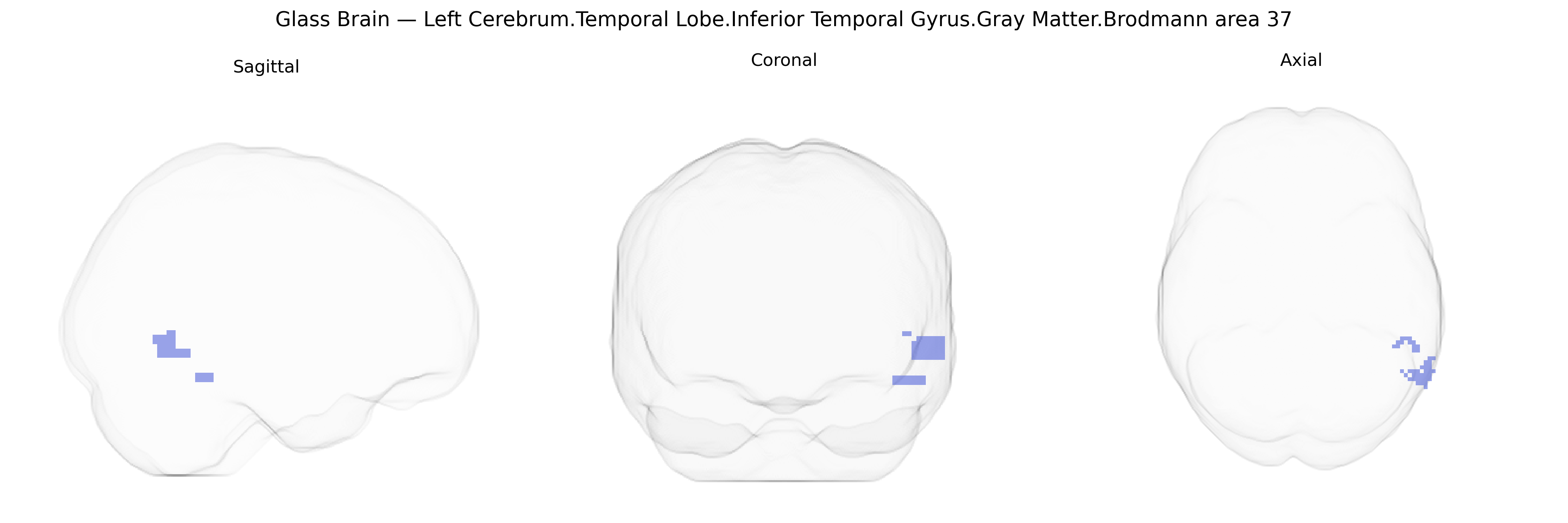 Triplanar Ghost Brain