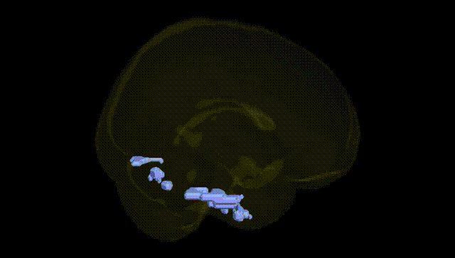 Full Brain Black