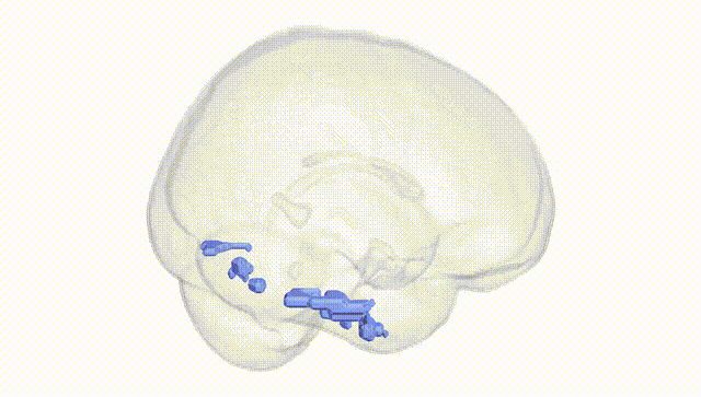Full Brain White