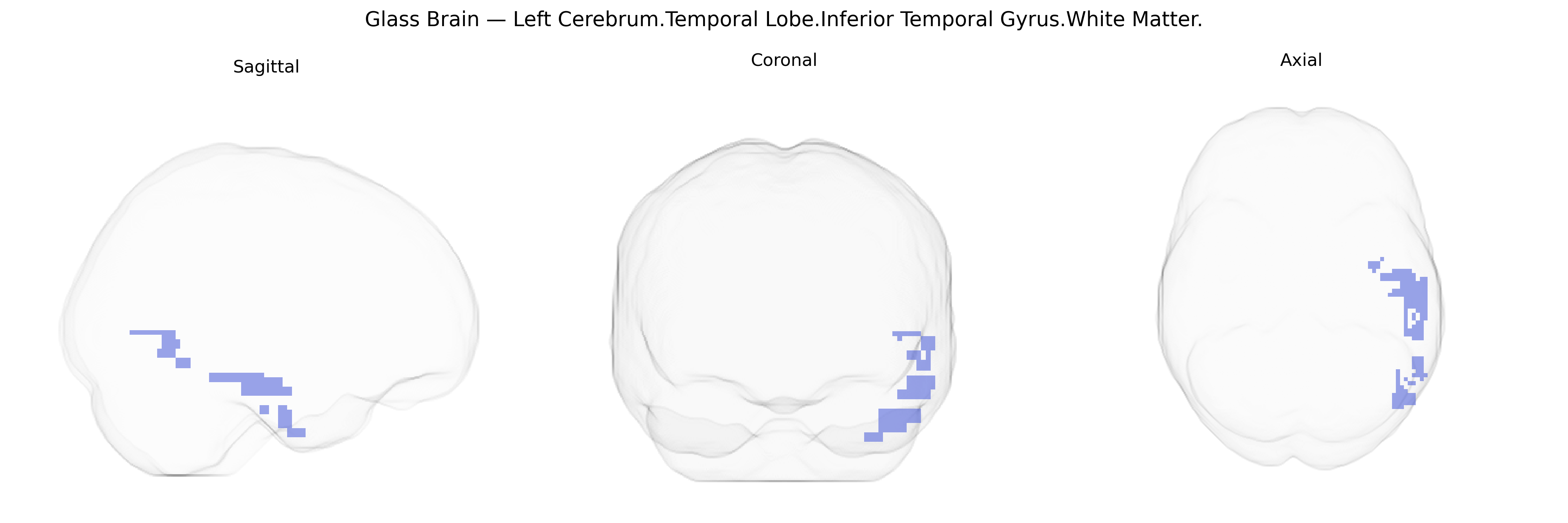 Triplanar Ghost Brain
