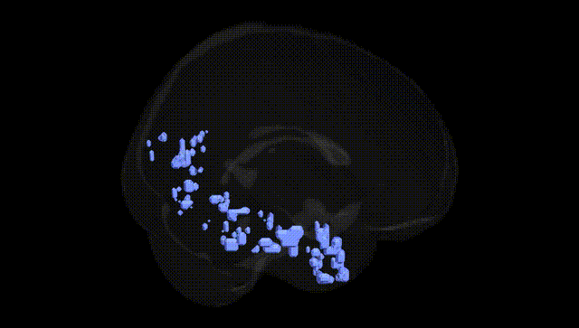 Full Brain Black