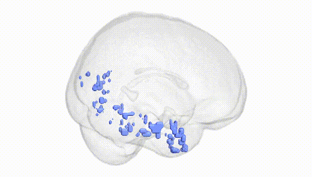 Full Brain White