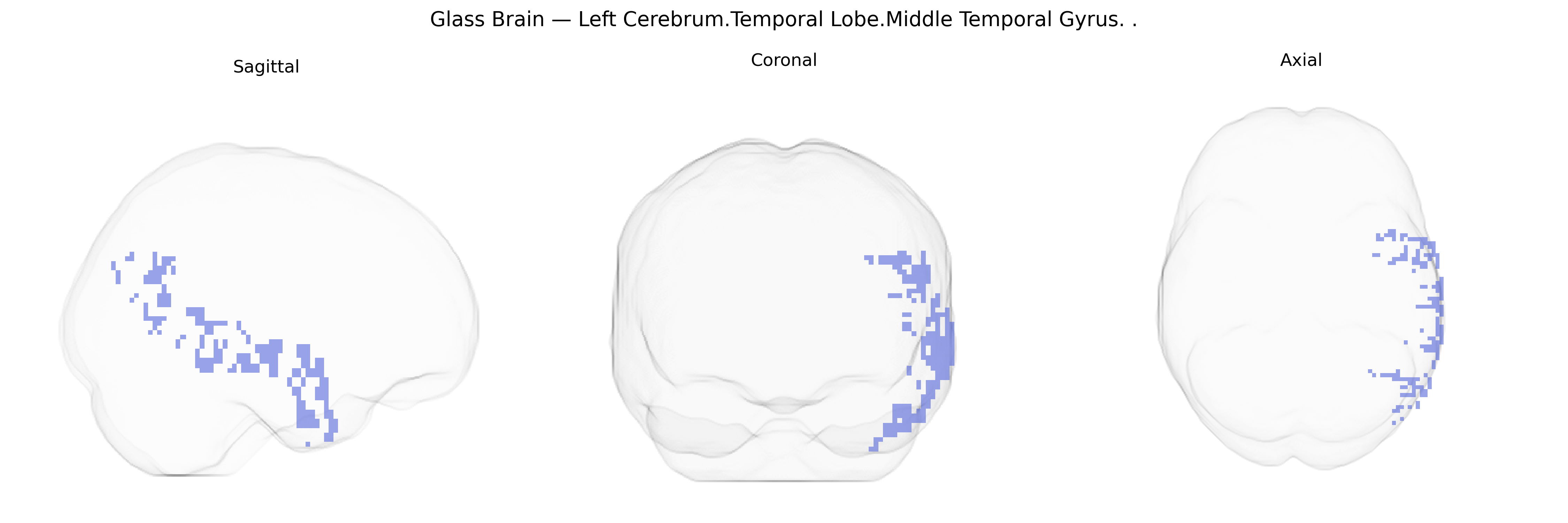 Triplanar Ghost Brain