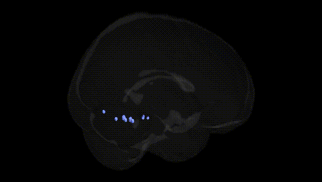 Full Brain Black