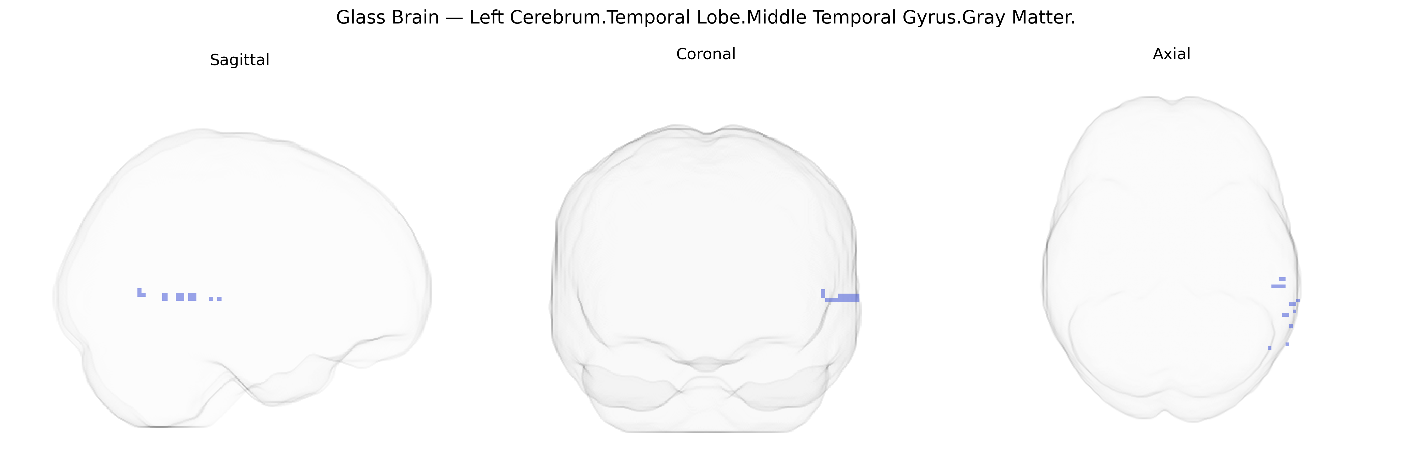 Triplanar Ghost Brain