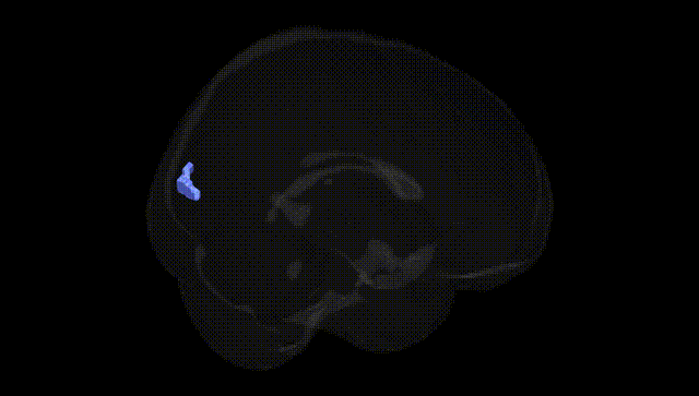 Full Brain Black