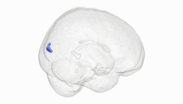 Full Brain White