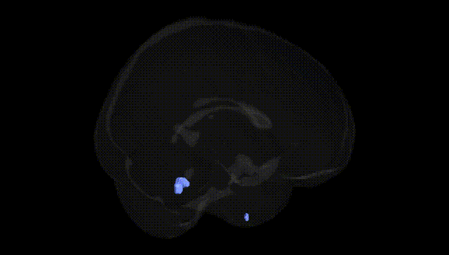 Full Brain Black