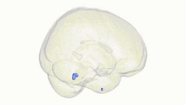 Full Brain White