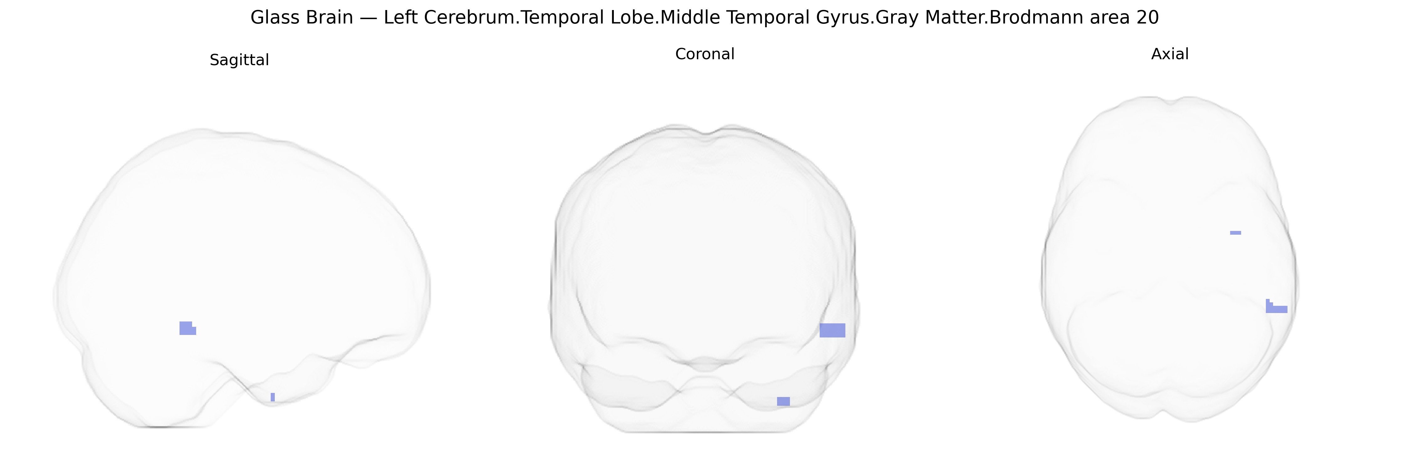 Triplanar Ghost Brain