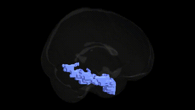 Full Brain Black
