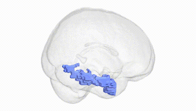 Full Brain White