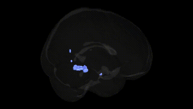 Full Brain Black