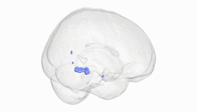 Full Brain White