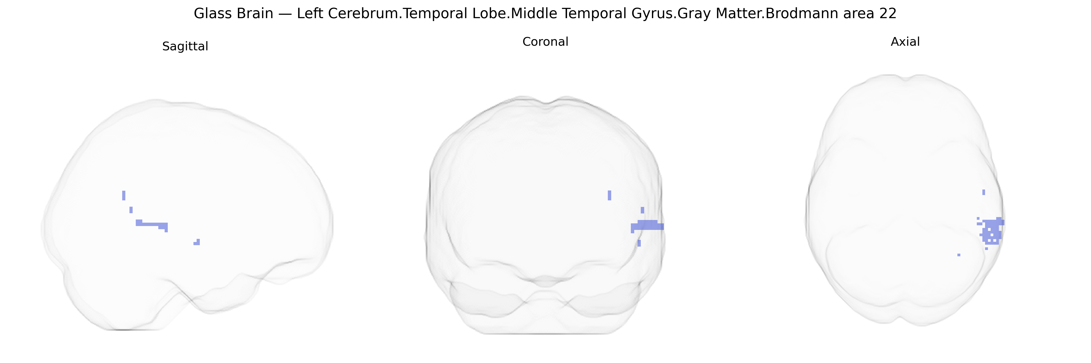 Triplanar Ghost Brain