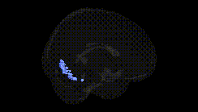 Full Brain Black