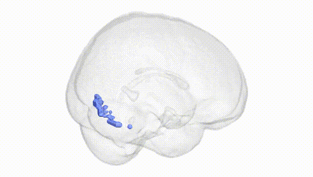 Full Brain White