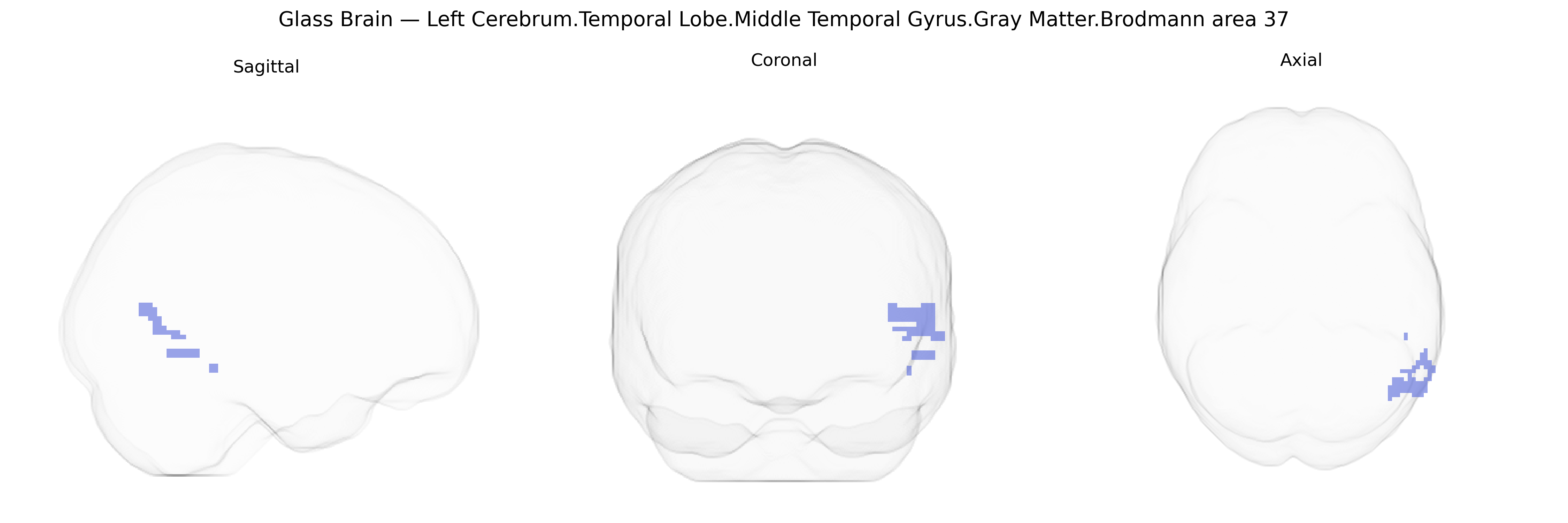 Triplanar Ghost Brain