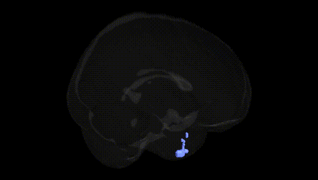 Full Brain Black