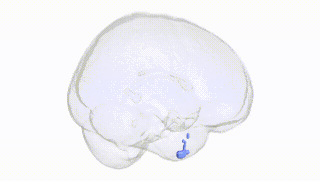 Full Brain White