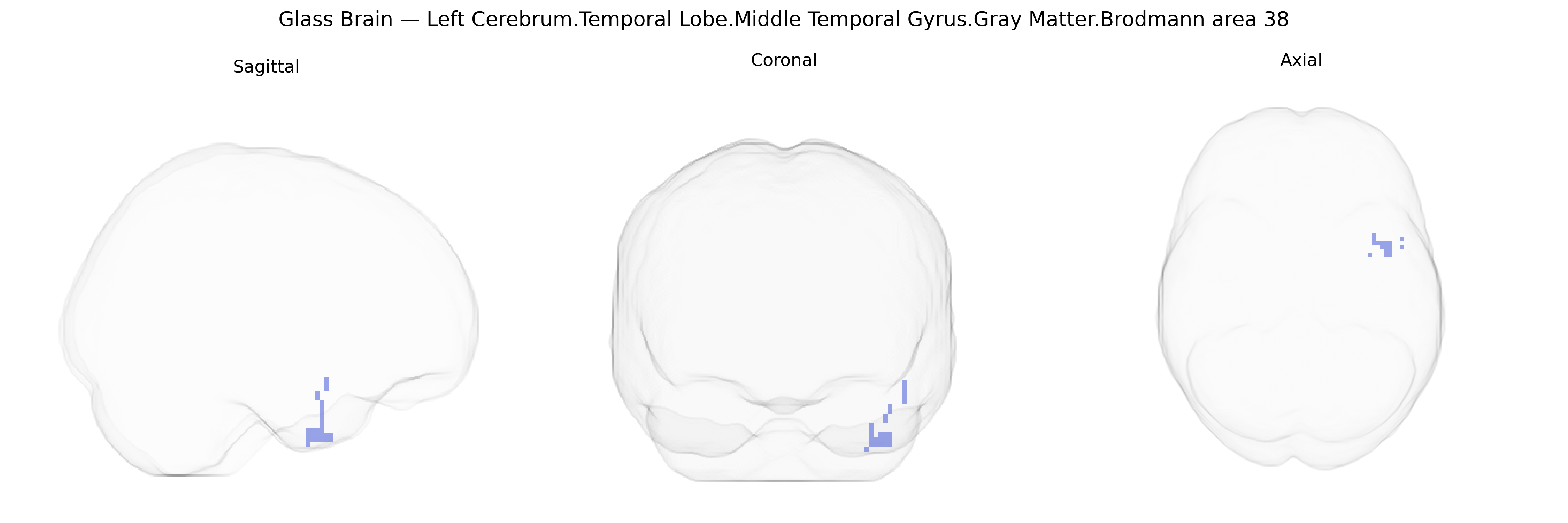 Triplanar Ghost Brain