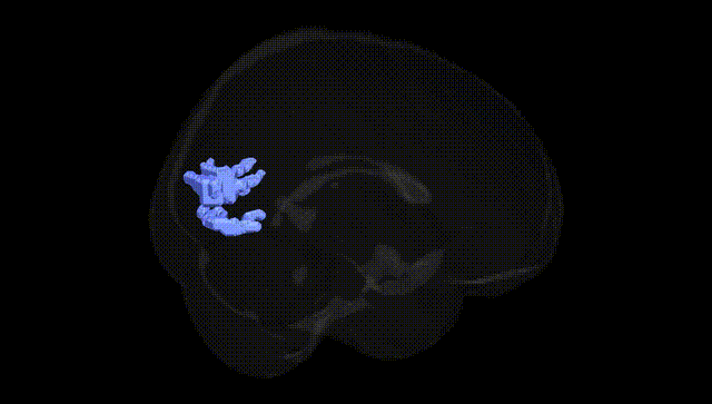 Full Brain Black