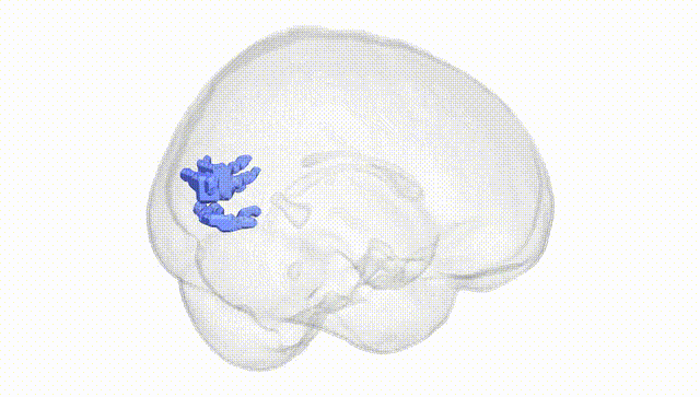 Full Brain White