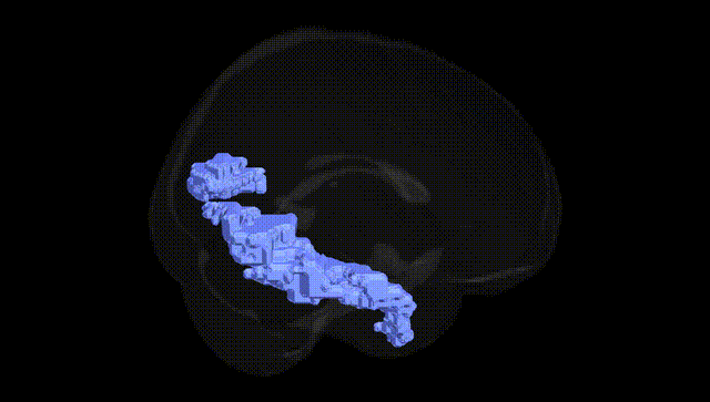 Full Brain Black