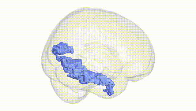 Full Brain White
