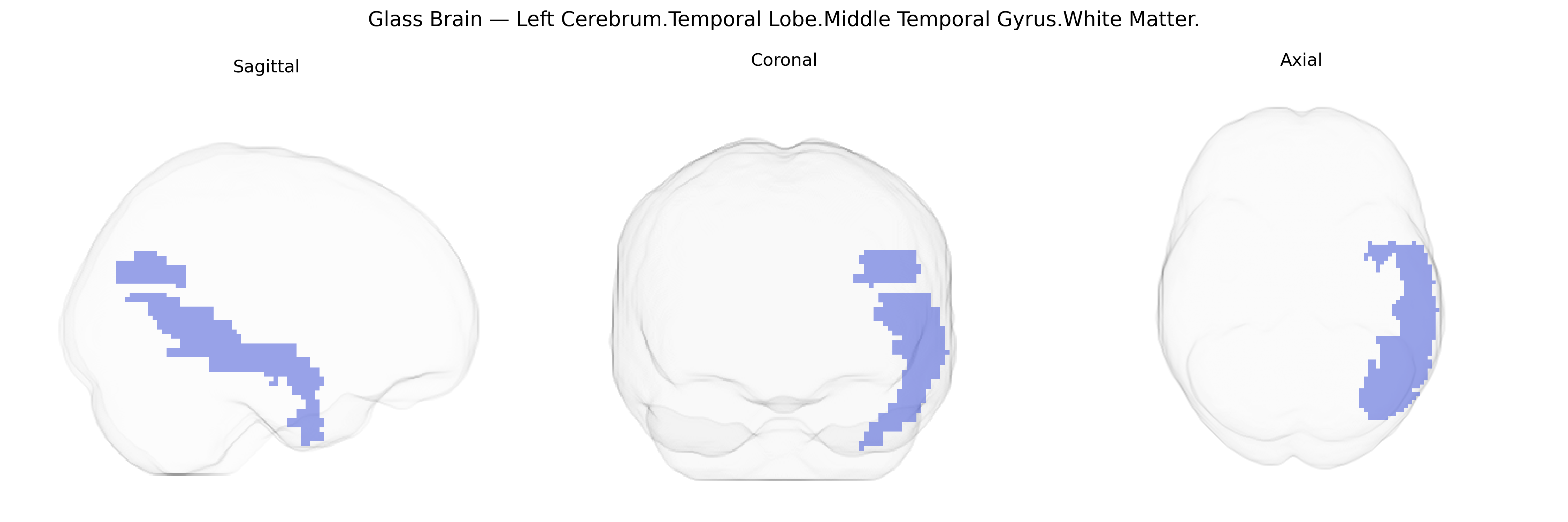 Triplanar Ghost Brain