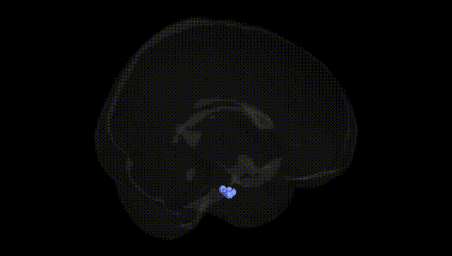 Full Brain Black