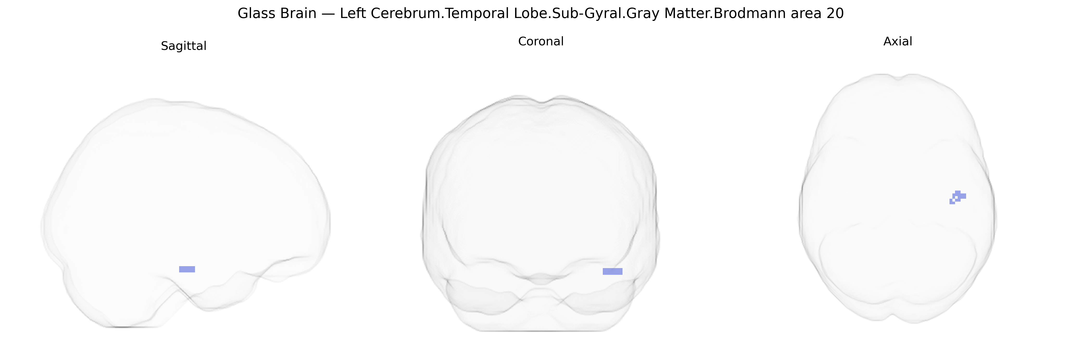 Triplanar Ghost Brain