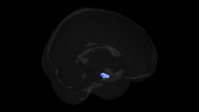 Full Brain Black