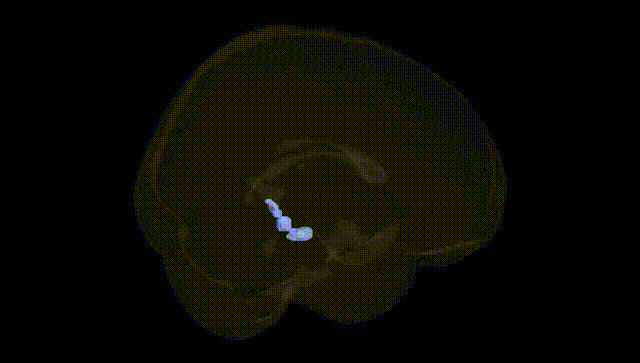 Full Brain Black