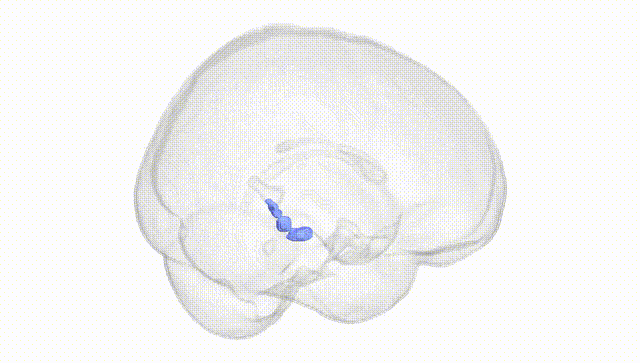 Full Brain White