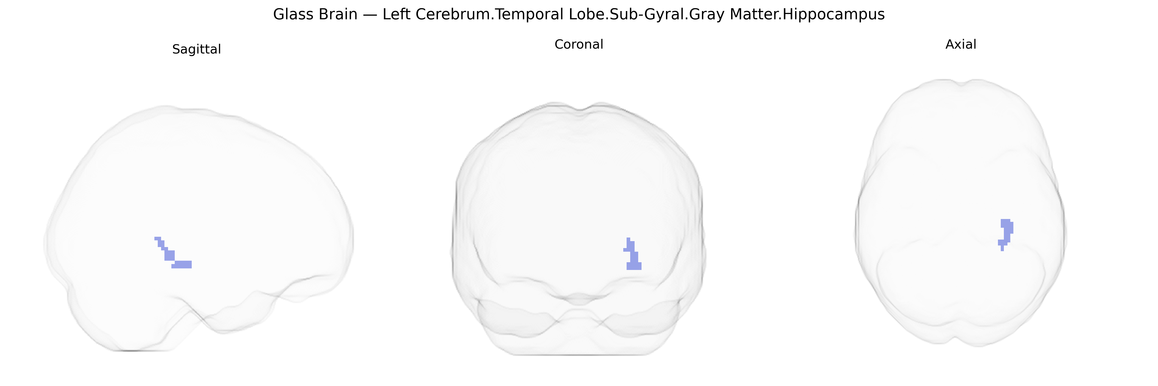 Triplanar Ghost Brain