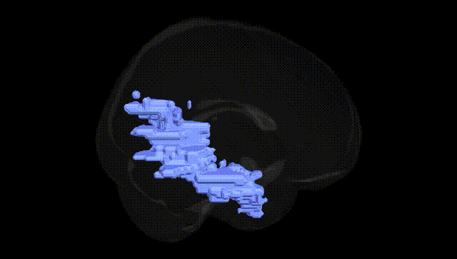 Full Brain Black