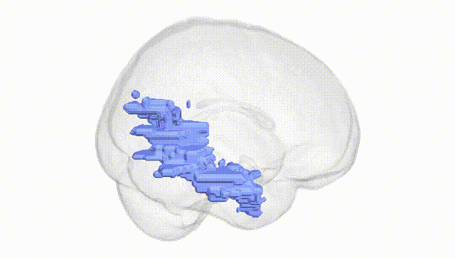 Full Brain White